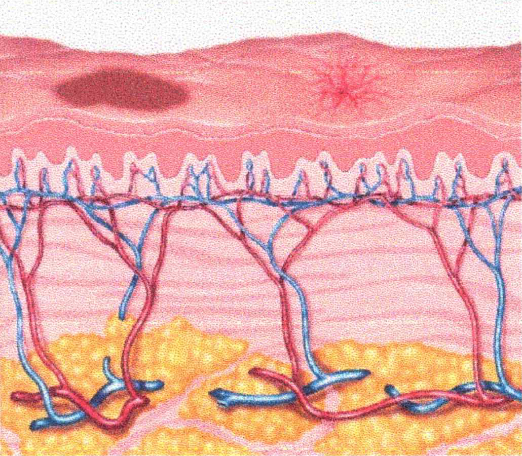 乾燥、紫外線によりメラニン色素が沈着して、シミ・ソバカスのできた肌。